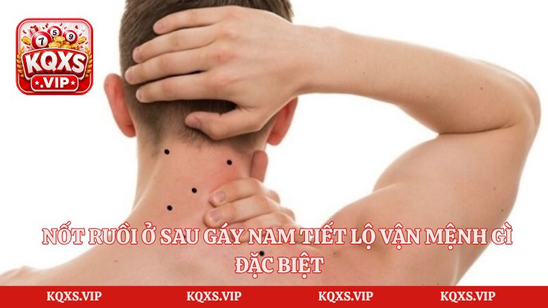 Nốt Ruồi Ở Sau Gáy Nam Tiết Lộ Vận Mệnh Gì Đặc Biệt