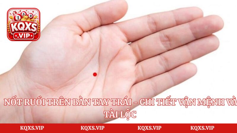 Nốt Ruồi Trên Bàn Tay Trái – Chi Tiết Vận Mệnh Và Tài Lộc
